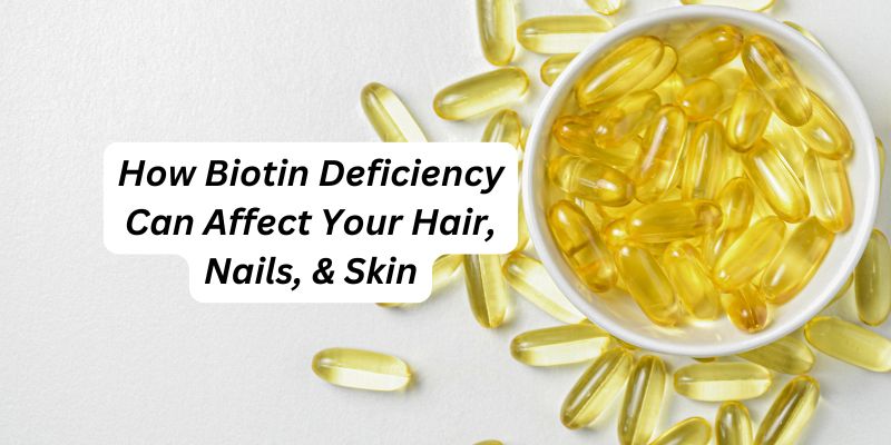 Biotin Deficiency: Causes, Signs, Symptoms, Treatments, And More