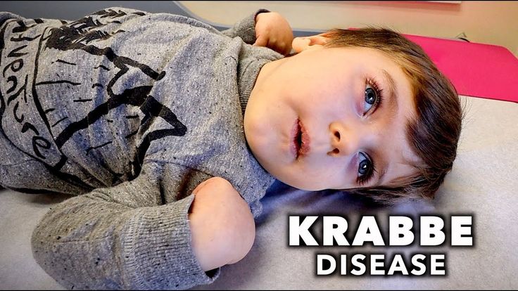 Treatment for Globoid Cell Leukodystrophy: A Practical Guide